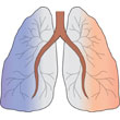 Anti-tumor immune responses in lung cancer